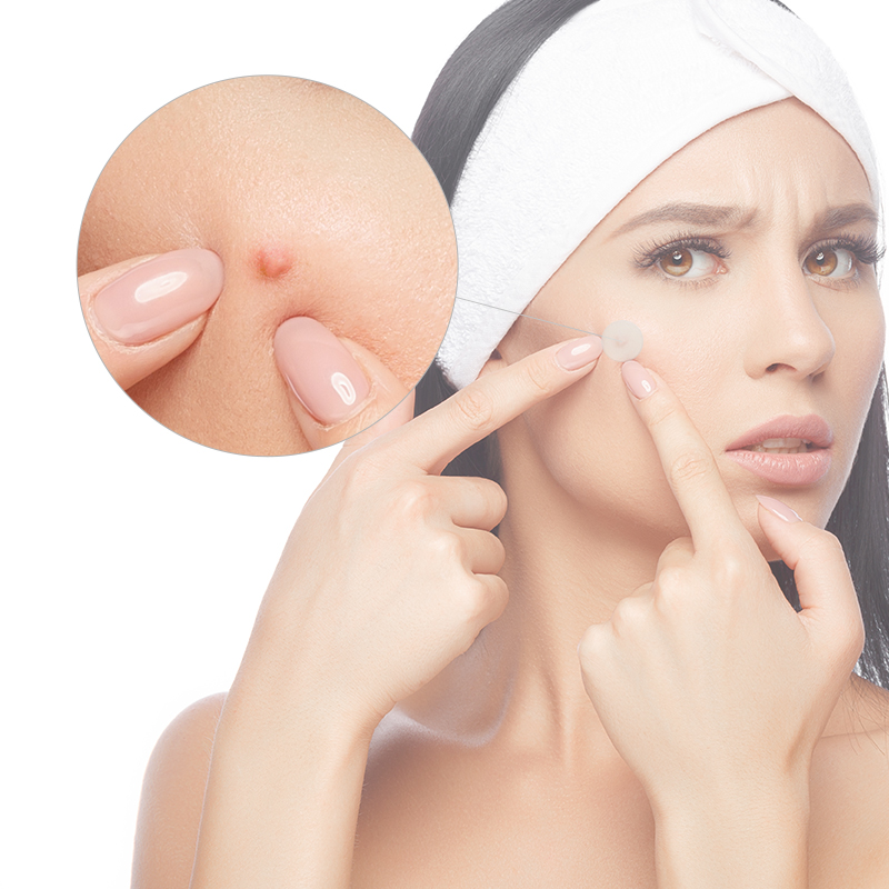 Adesivo para acne,Produtos OEM de Saúde e Bem-Estar | Fabricante de Soluções Personalizadas de Bem-Estar | Kongdy Health